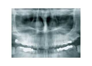 いとう歯科クリニック 深溝駅 *デジタルX線装置の写真